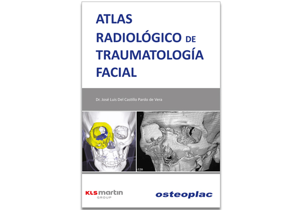ATLAS RADIOLÓGICO DE TRAUMATOLOGÍA FACIAL ATLAS RADIOLÓGICO DE TRAUMATOLOGÍA FACIAL