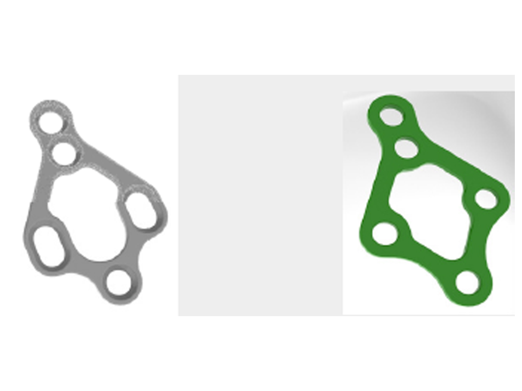 Placa romboidal tridimensional para fractura condilar | Osteoplac