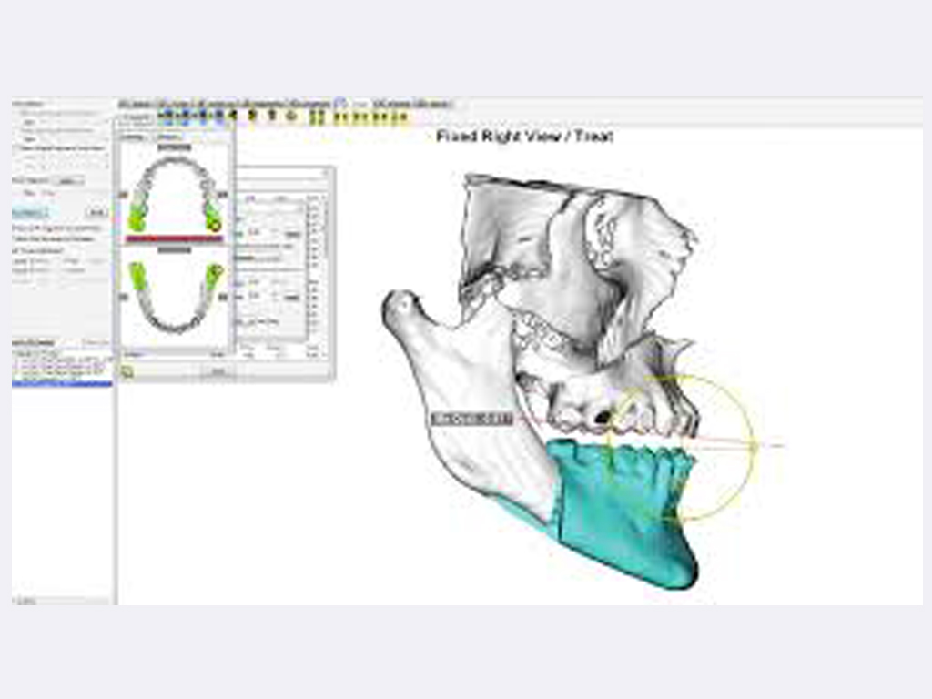 Taller Planificación 3D en Cirugía Ortognática (dentro del XI Congreso SVMCOM)