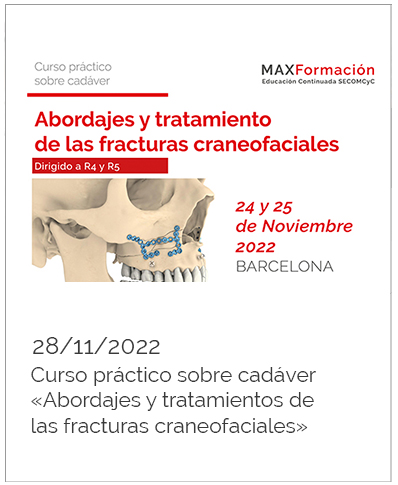 Noticias Osteoplac