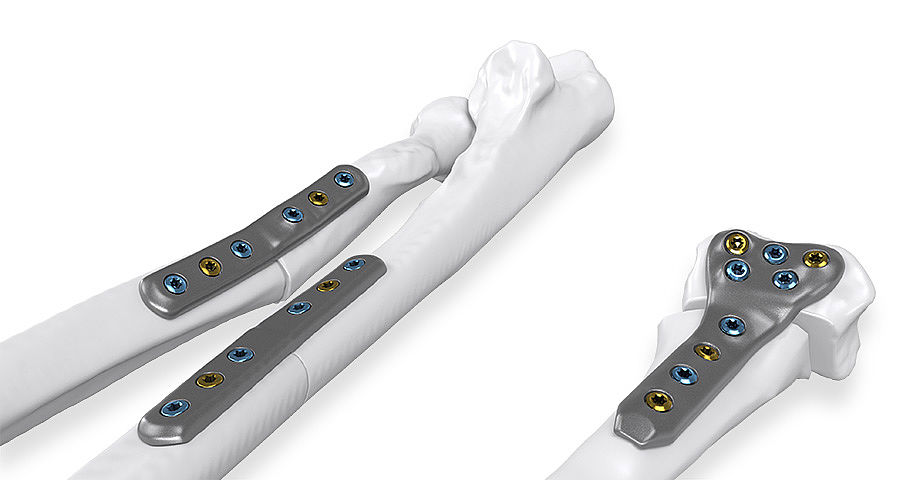 Individual Patient Solutions IPS
