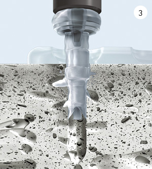 SISTEMA SONICWELD-RX<sup>®</sup> EN 4 PASOS SISTEMA SONICWELD-RX<sup>®</sup> EN 4 PASOS