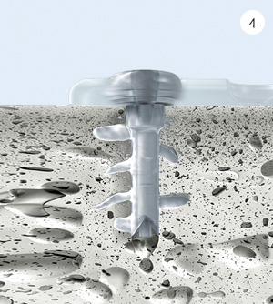 SISTEMA SONICWELD-RX<sup>®</sup> EN 4 PASOS SISTEMA SONICWELD-RX<sup>®</sup> EN 4 PASOS